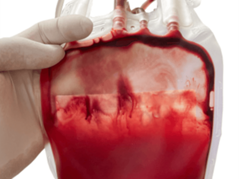 高频机在血袋制造中扮演的角色是什么？